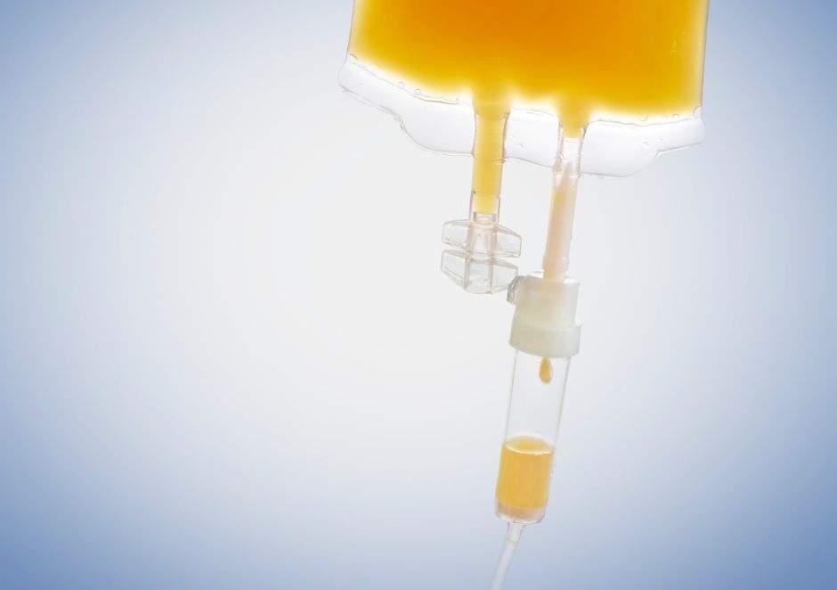 Orange liquid in an IV bag